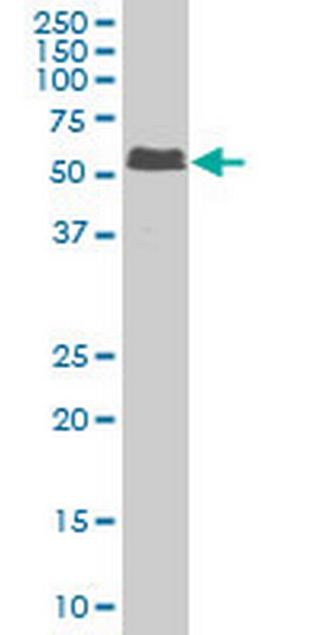 SMAD5 Antibody in Western Blot (WB)