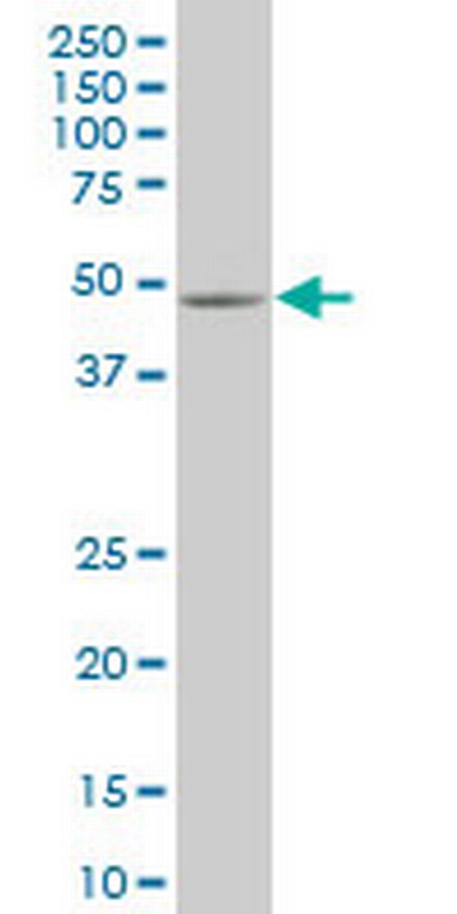 SMAD5 Antibody in Western Blot (WB)