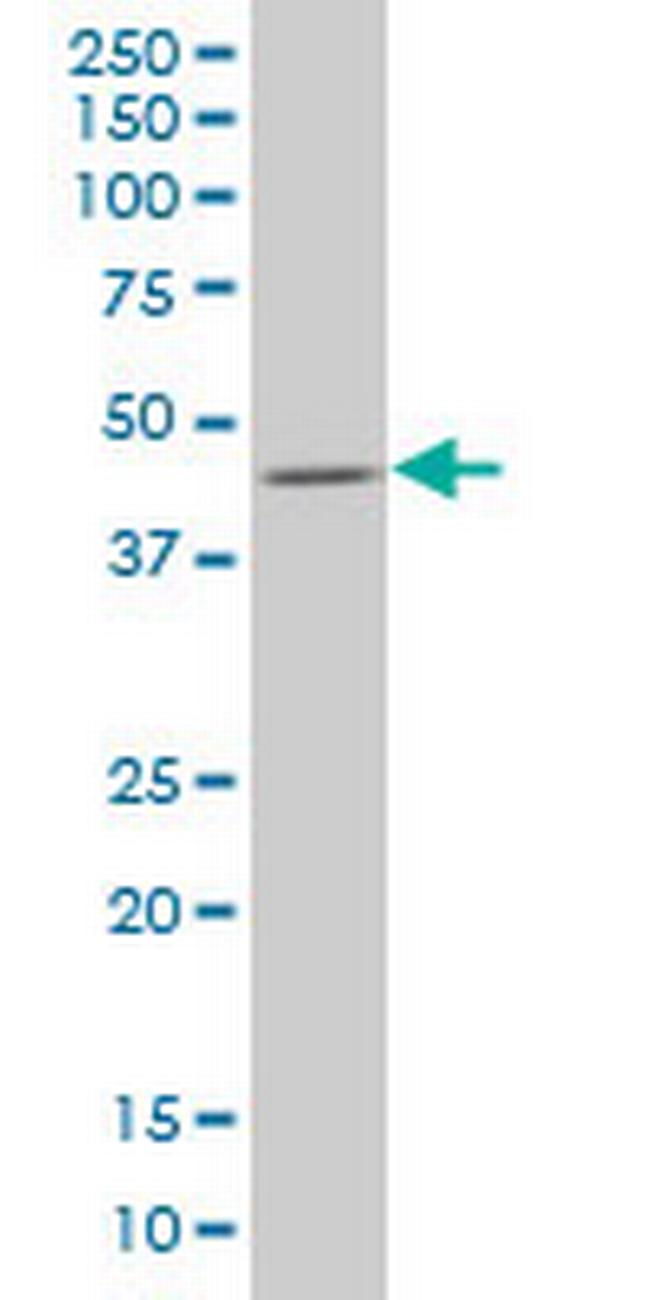 SMAD7 Antibody in Western Blot (WB)