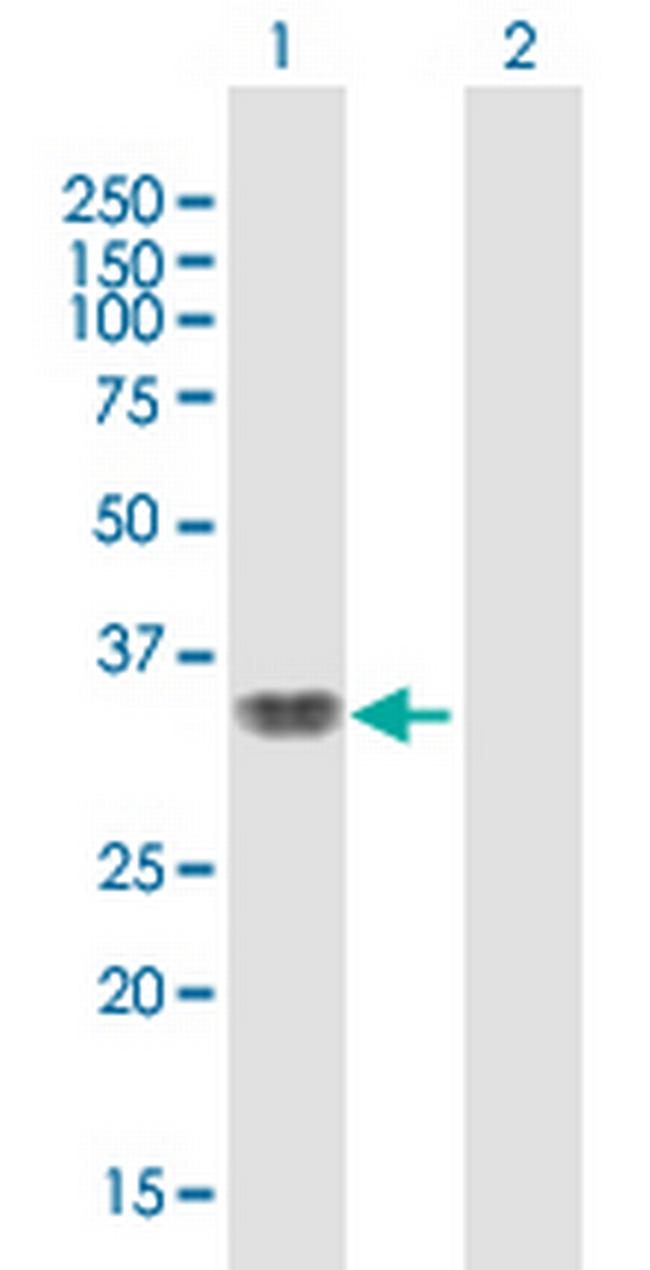 SMAD9 Antibody in Western Blot (WB)