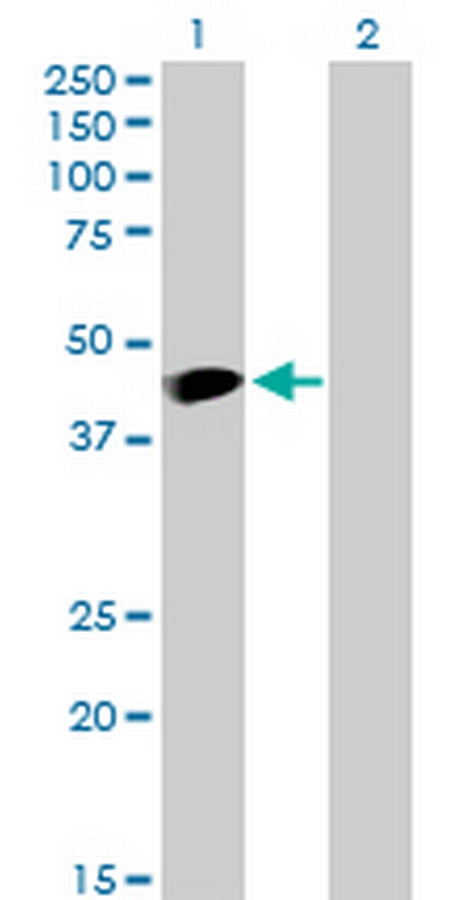 MAGEA3 Antibody in Western Blot (WB)