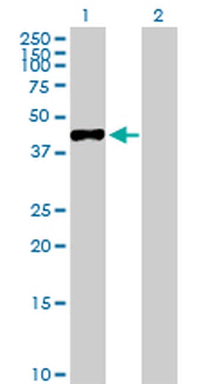 MAGEA3 Antibody in Western Blot (WB)