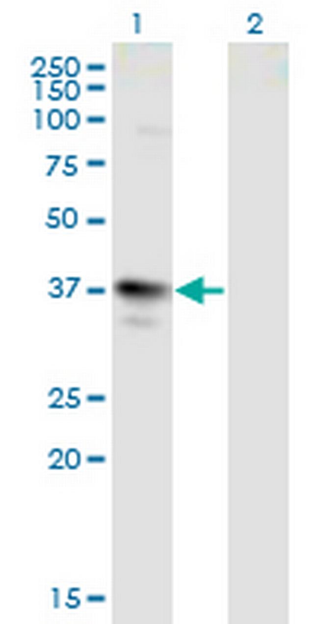 MAGEA3 Antibody in Western Blot (WB)