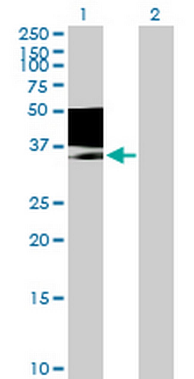 MAGEB1 Antibody in Western Blot (WB)