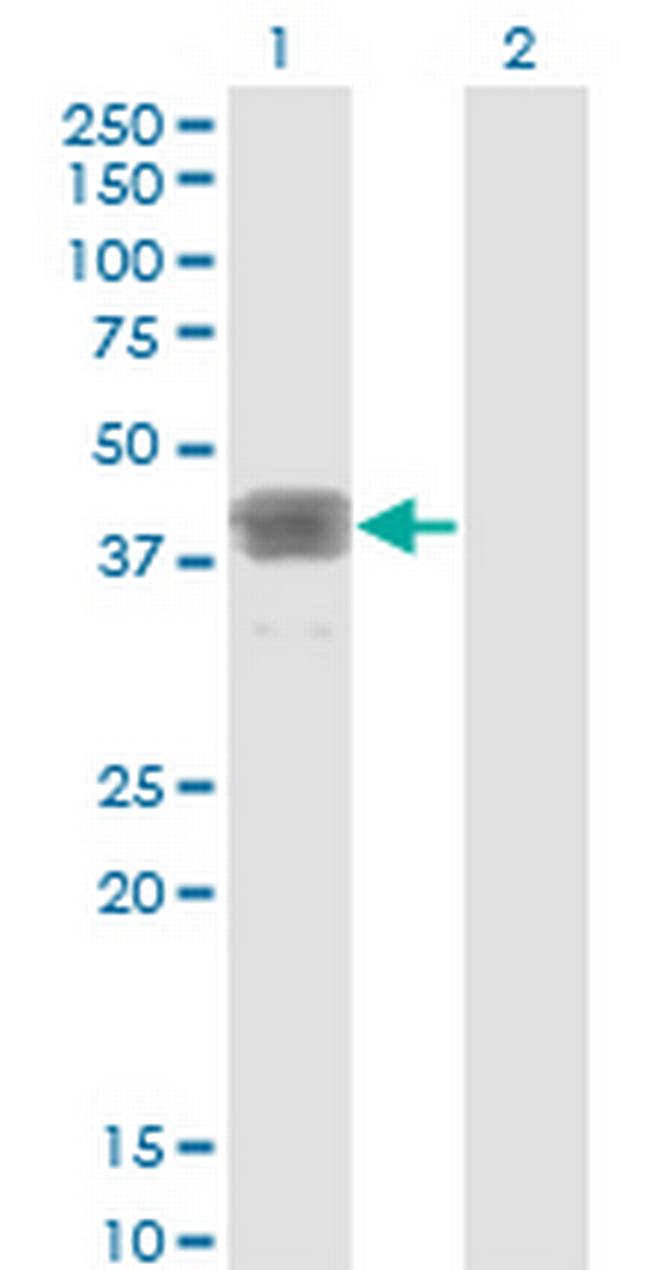 MAGEB1 Antibody in Western Blot (WB)