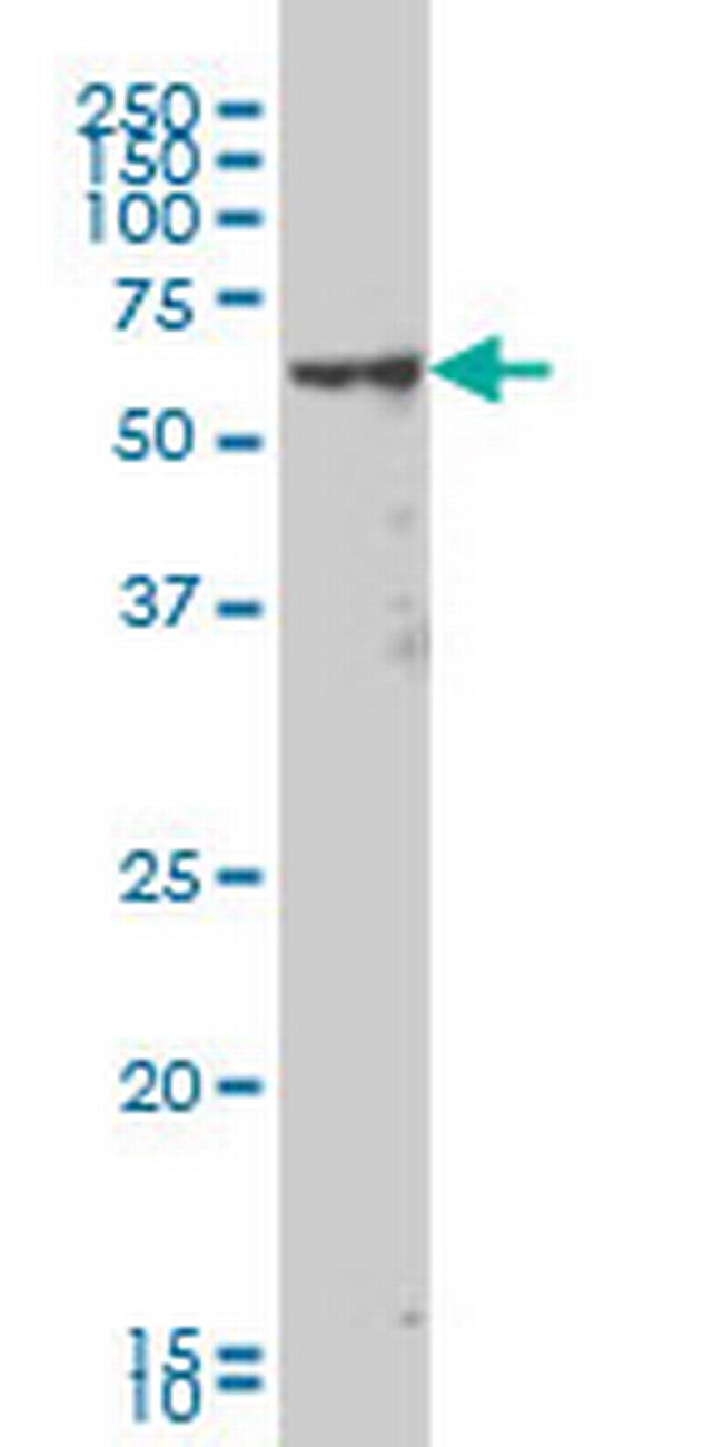 MAK Antibody in Western Blot (WB)