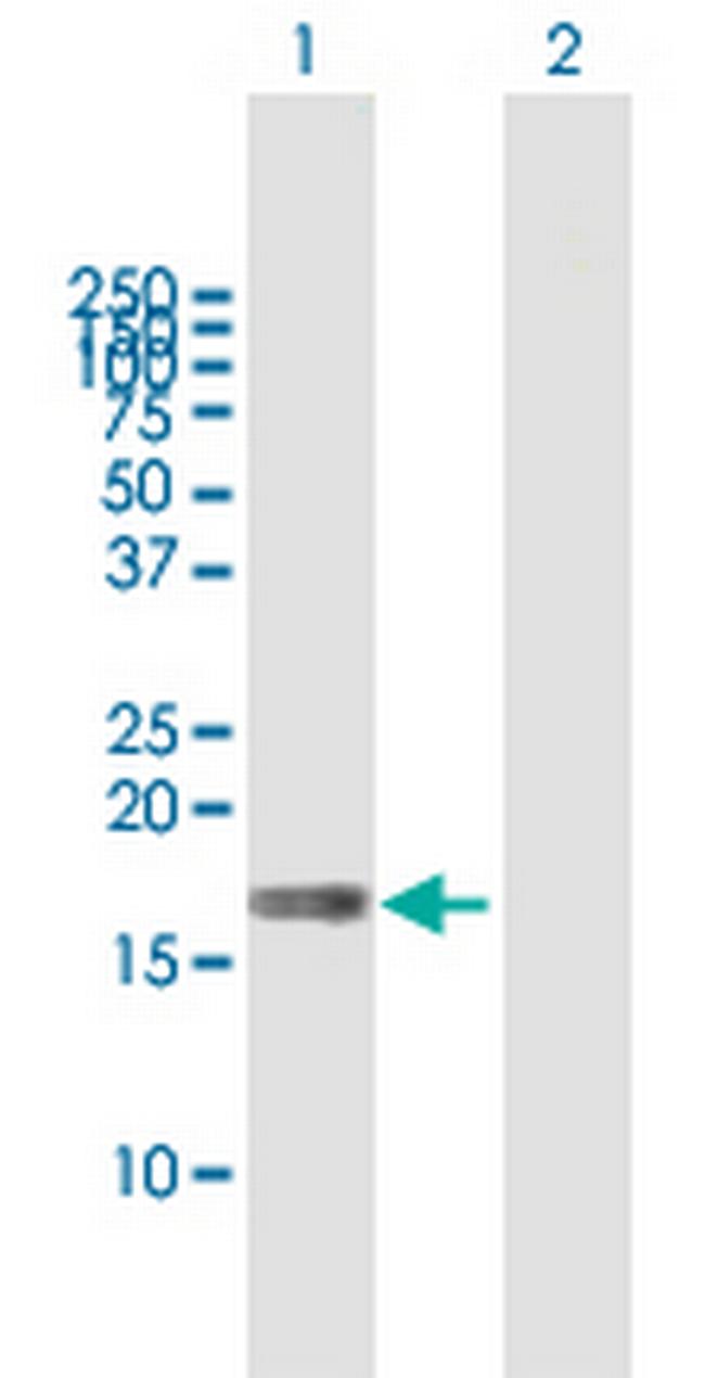 MAL Antibody in Western Blot (WB)