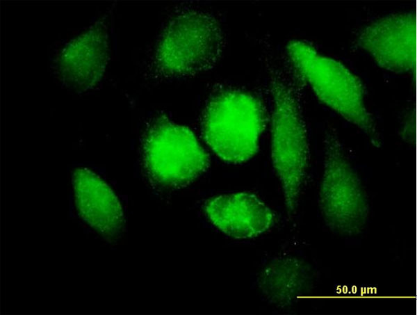 MAOB Antibody in Immunocytochemistry (ICC/IF)