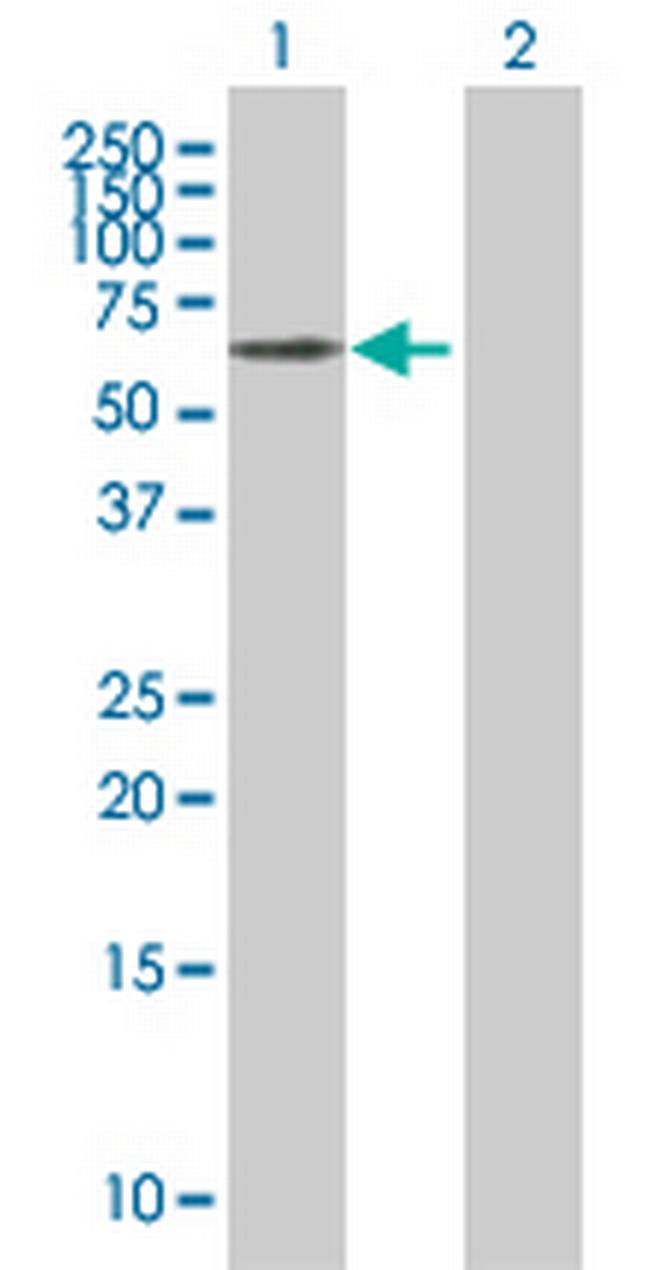 MAP2 Antibody in Western Blot (WB)