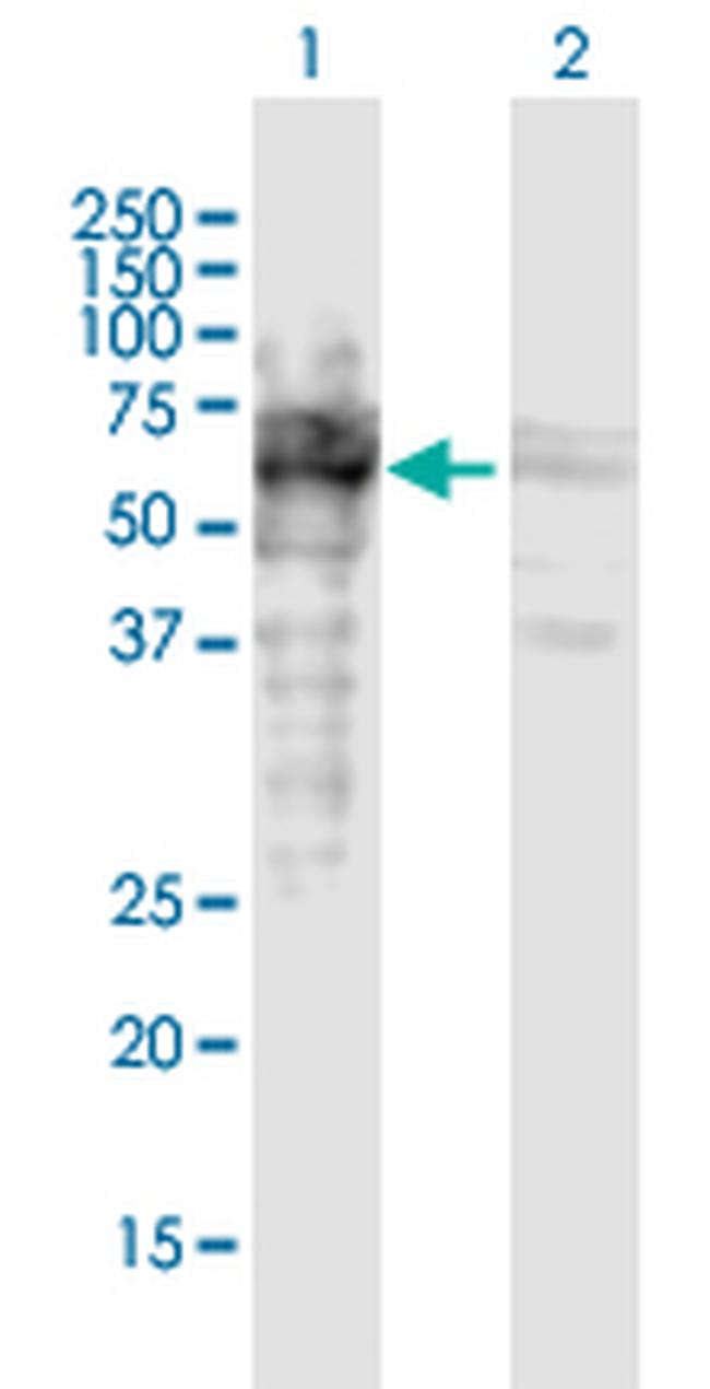 MAP2 Polyclonal Antibody (H00004133-D01P)