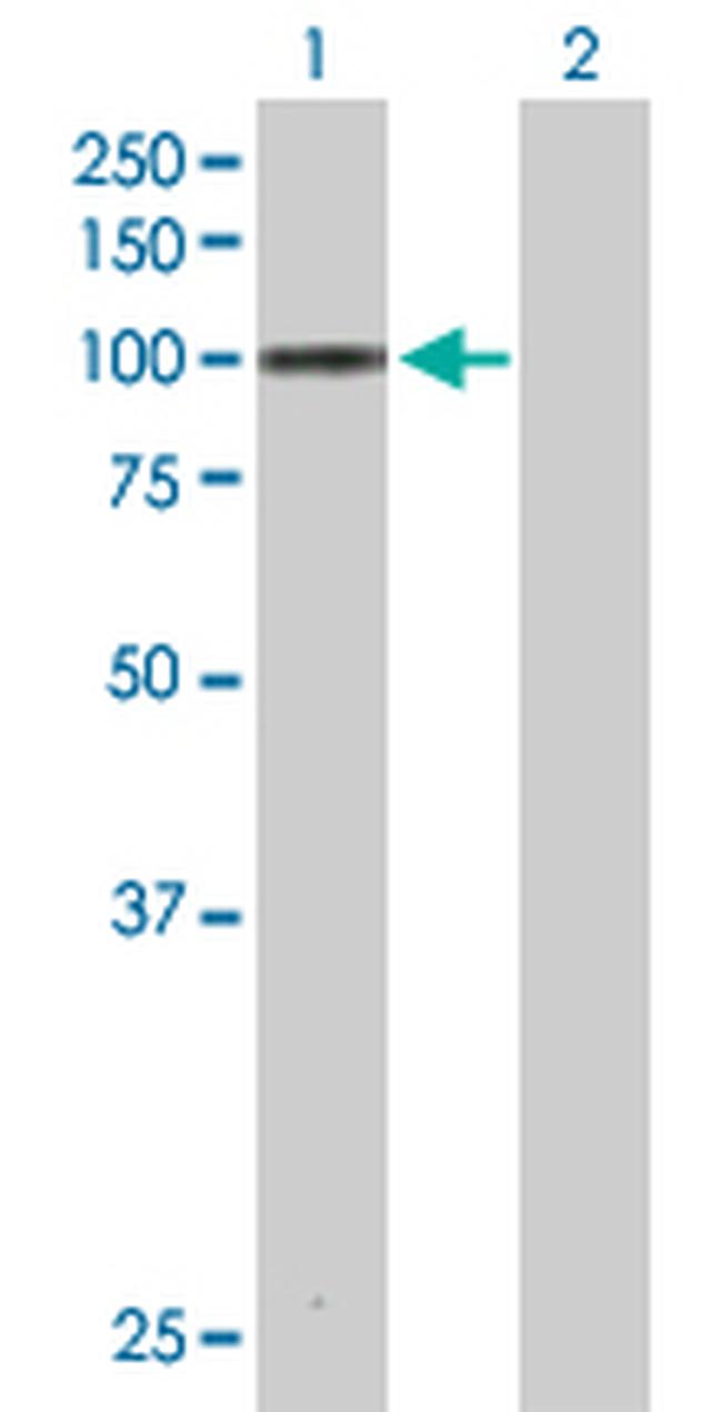 MARK3 Antibody in Western Blot (WB)