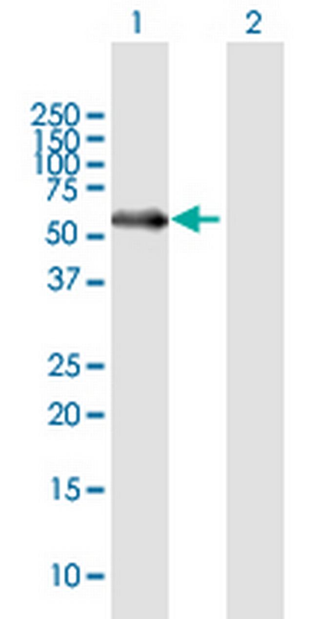 MATN1 Antibody in Western Blot (WB)