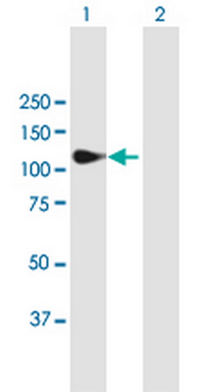 MATN2 Antibody in Western Blot (WB)