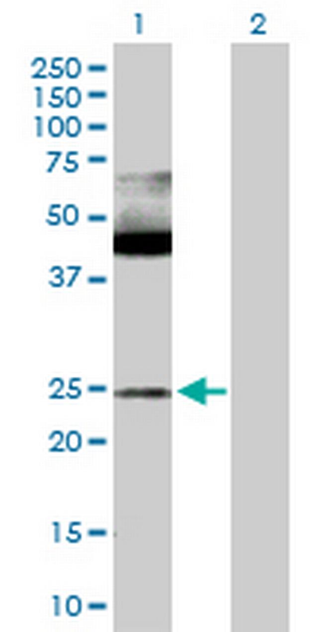 MAX Antibody in Western Blot (WB)