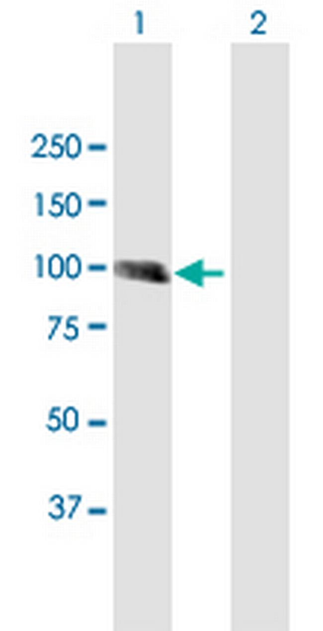 MCC Antibody in Western Blot (WB)
