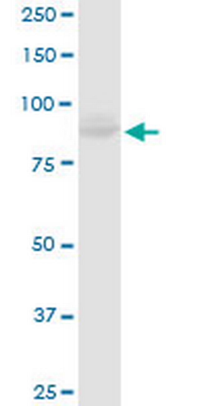 MCM4 Antibody in Western Blot (WB)