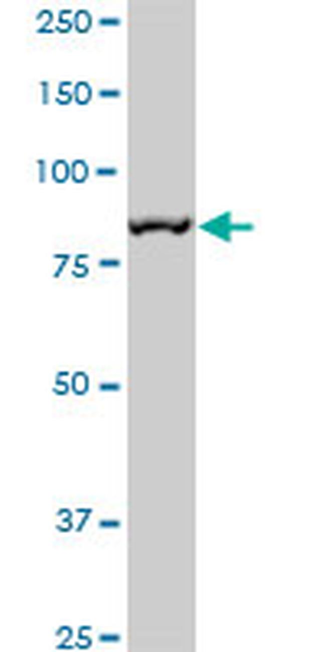MCM5 Antibody in Western Blot (WB)
