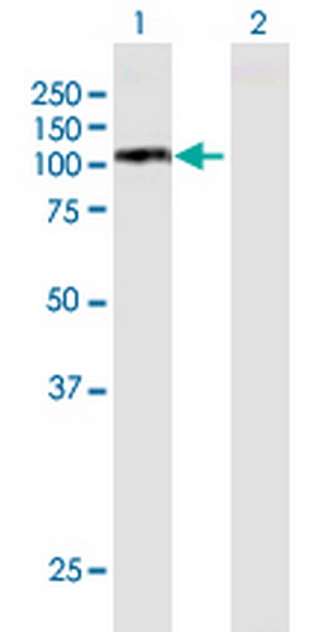 MCM6 Antibody in Western Blot (WB)