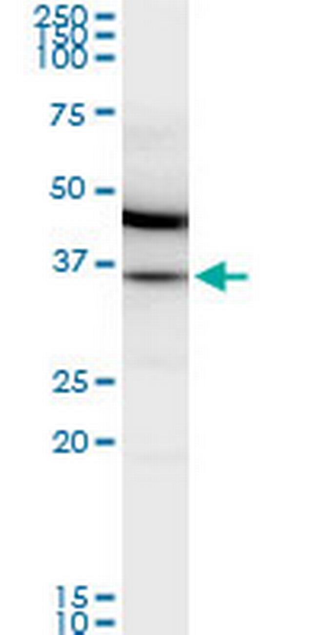MDH2 Antibody in Western Blot (WB)