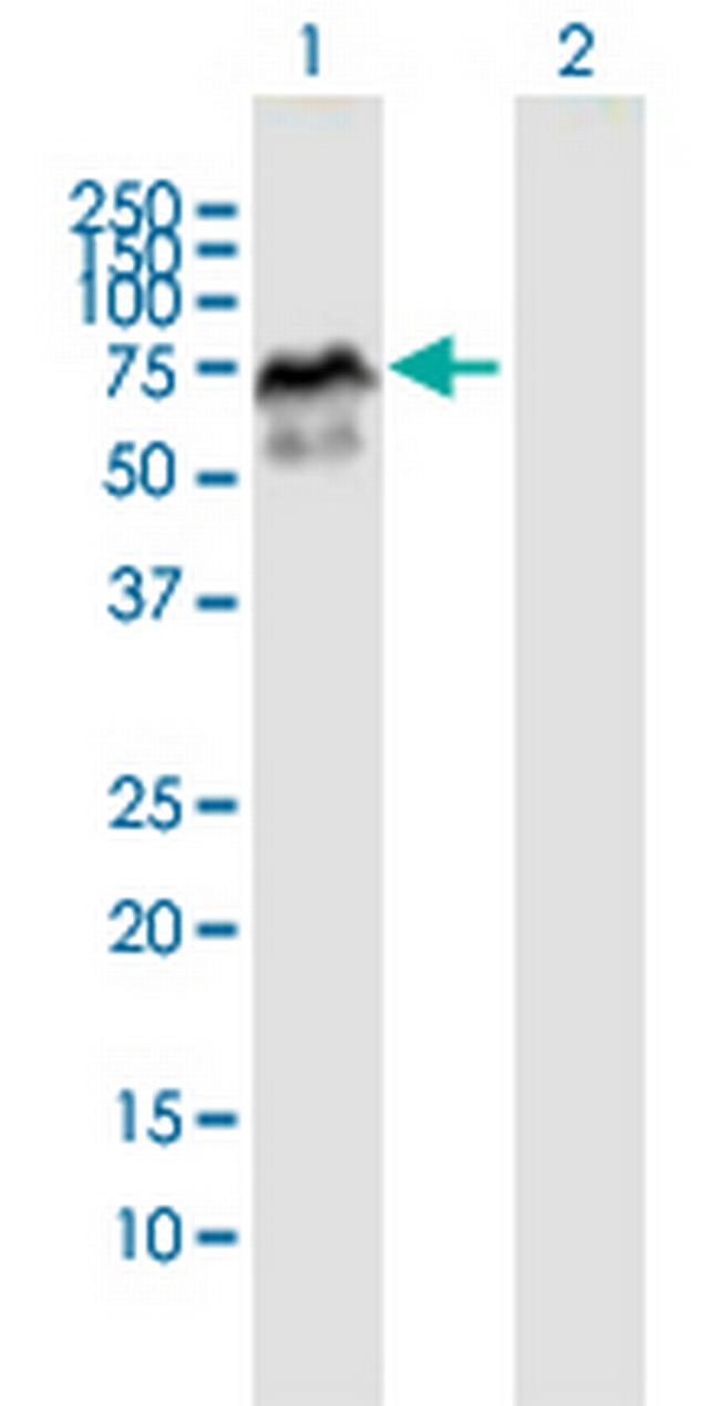 MDM4 Antibody in Western Blot (WB)
