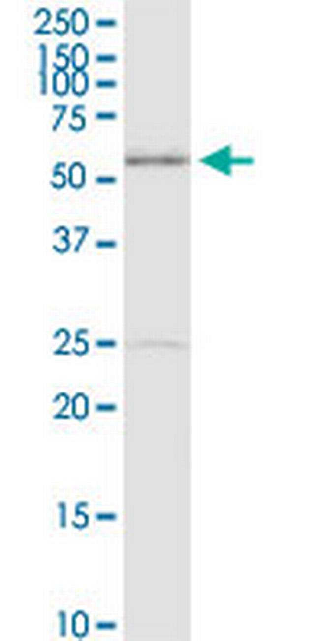 MDM4 Antibody in Western Blot (WB)