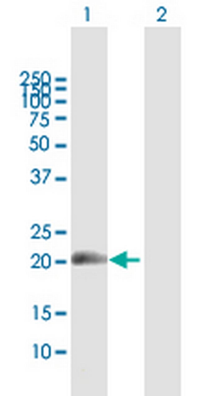 MDS1 Antibody in Western Blot (WB)