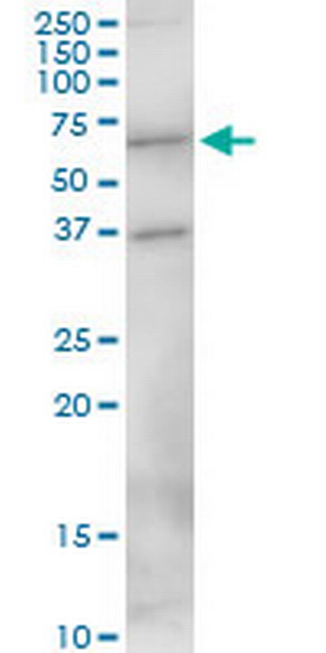 MEF2D Antibody in Western Blot (WB)