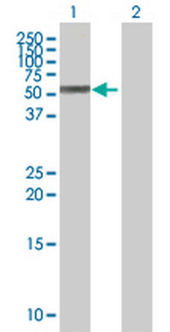 MEIS2 Antibody in Western Blot (WB)