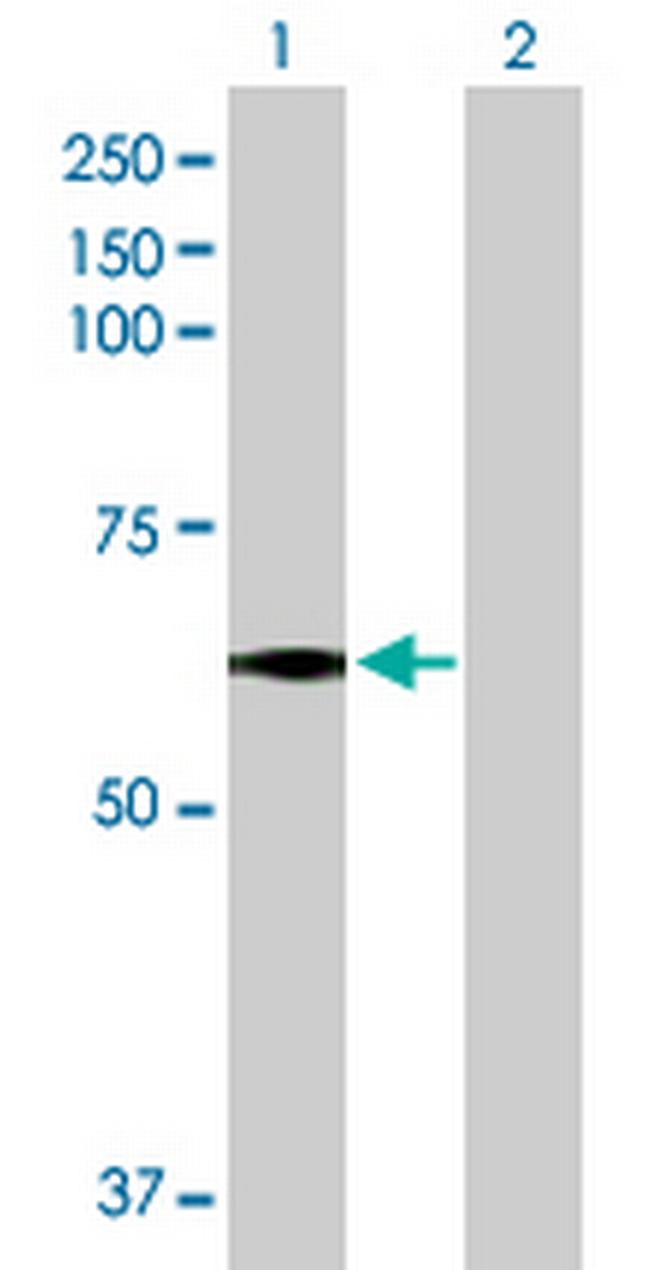 MEIS2 Antibody in Western Blot (WB)