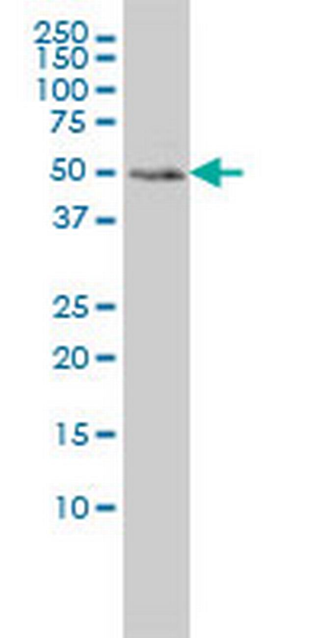 MEIS2 Antibody in Western Blot (WB)
