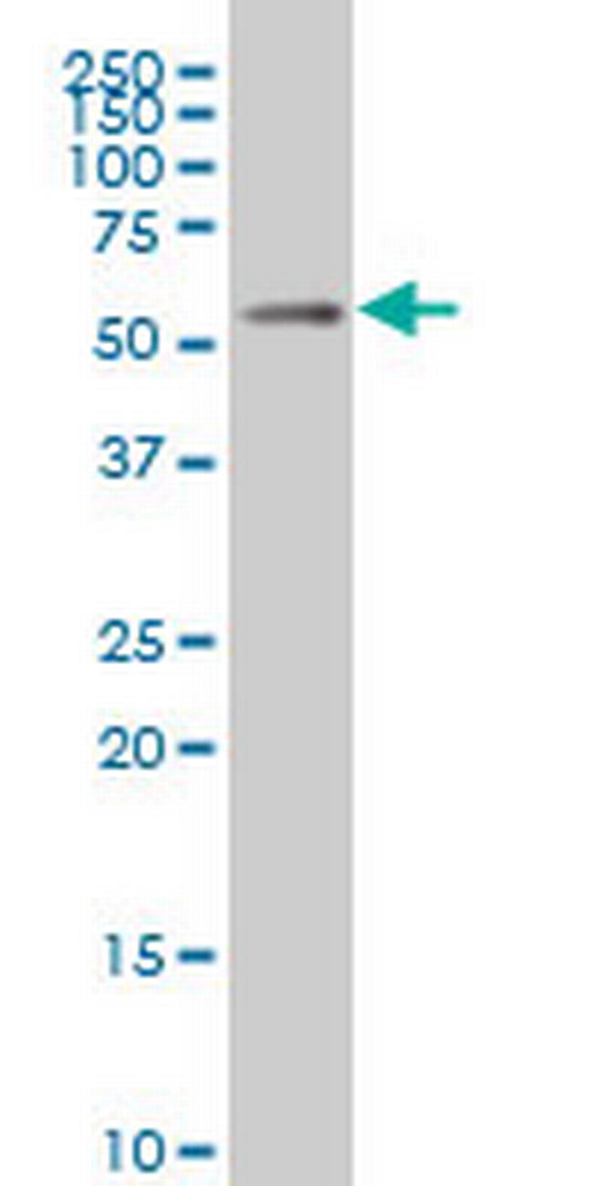 MEIS2 Antibody in Western Blot (WB)