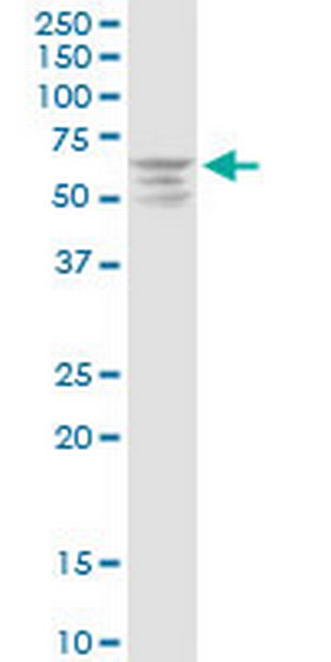 MAP3K3 Antibody in Western Blot (WB)