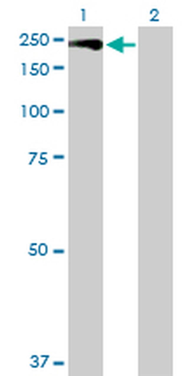 MAP3K5 Antibody in Western Blot (WB)