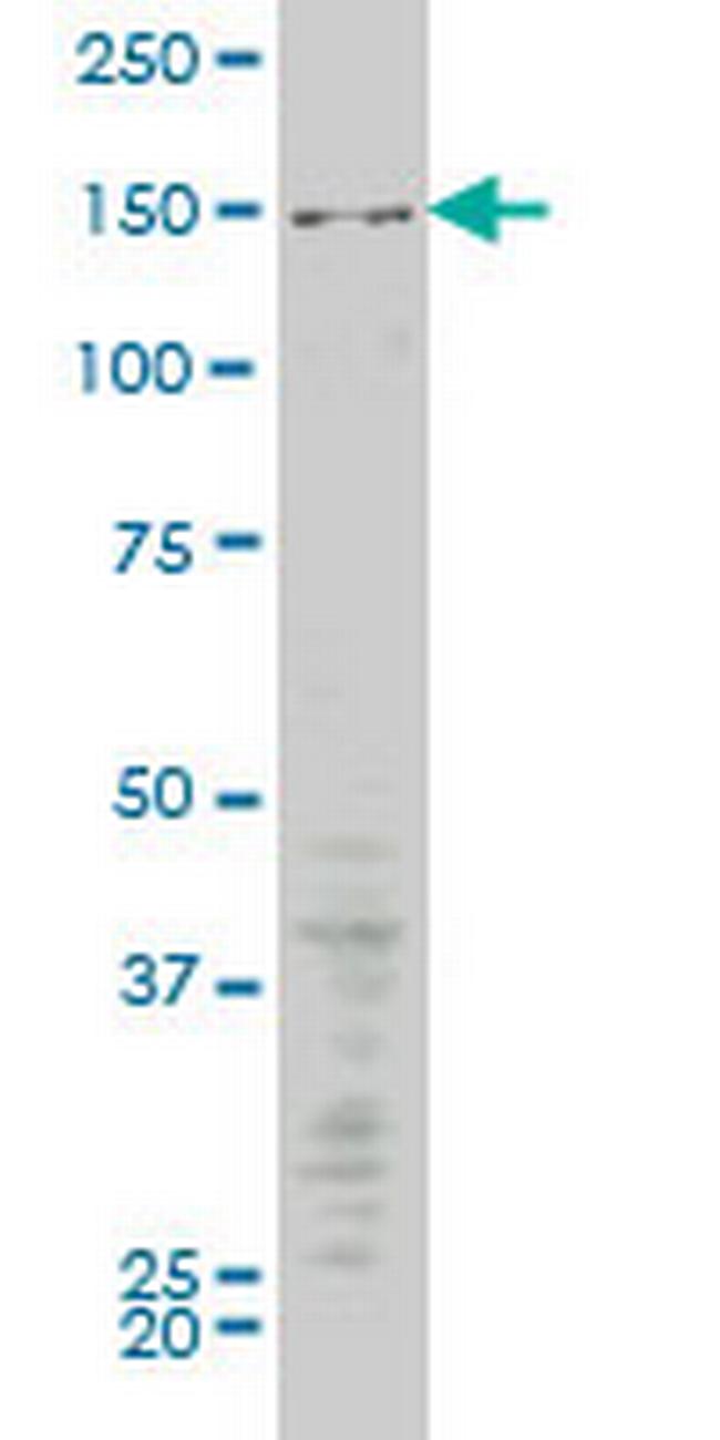 MAP3K5 Antibody in Western Blot (WB)