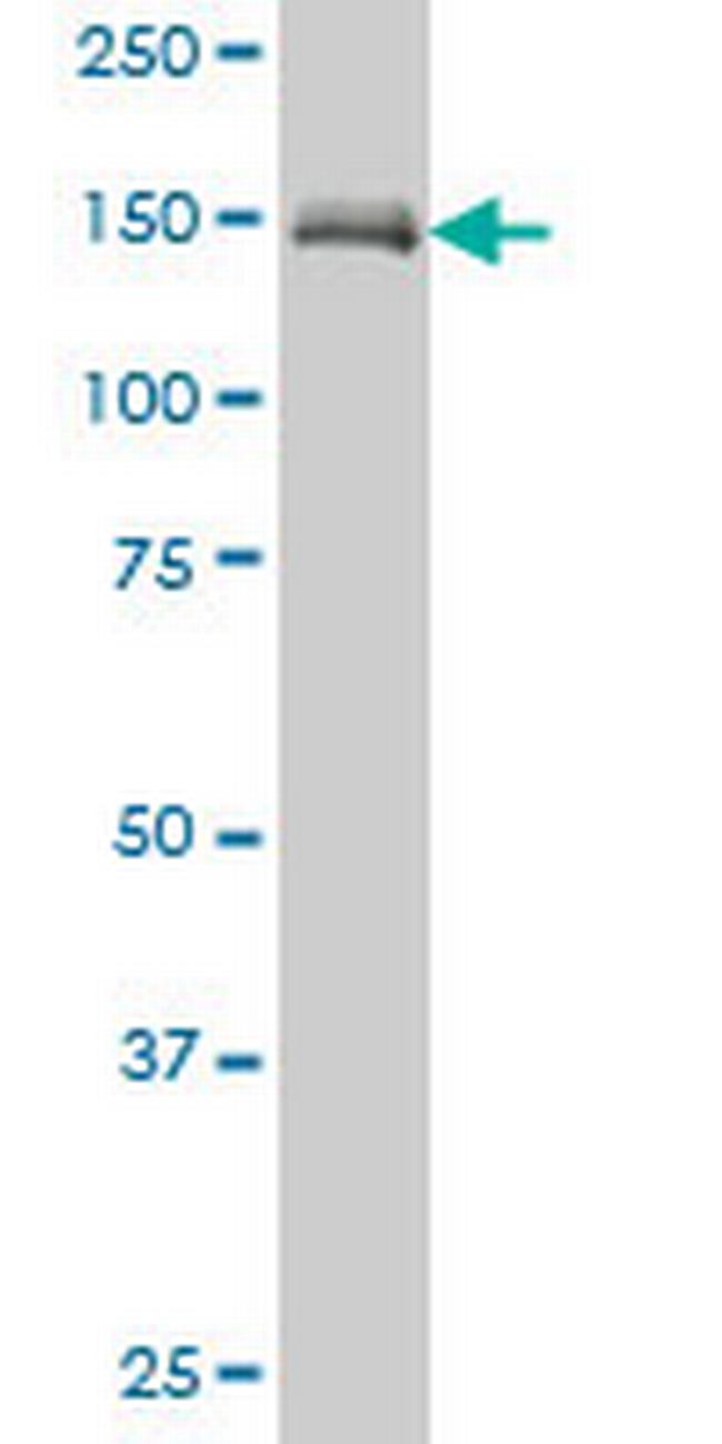 MAP3K5 Antibody in Western Blot (WB)