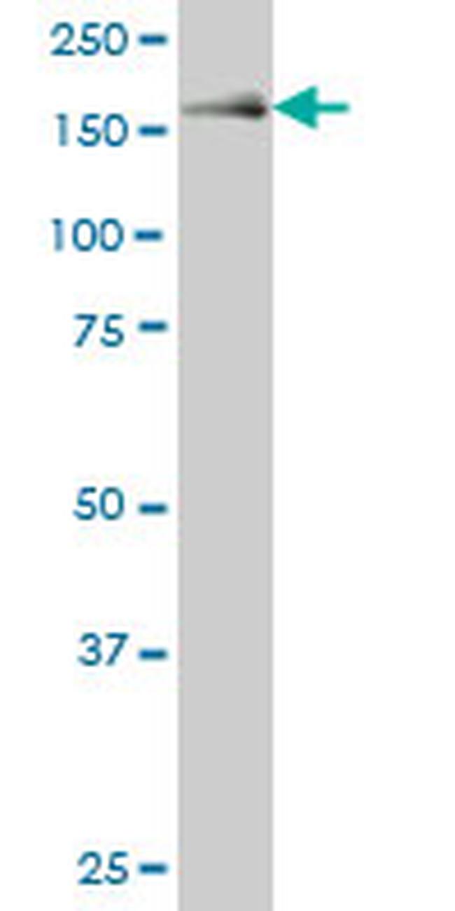 MAP3K5 Antibody in Western Blot (WB)