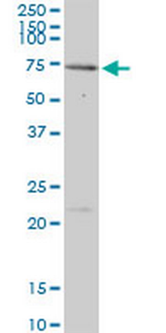 MEN1 Antibody in Western Blot (WB)