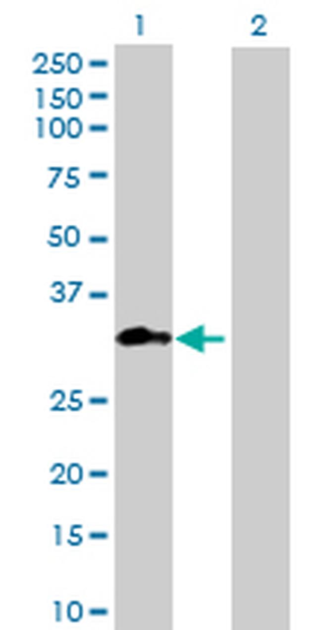 METTL1 Antibody in Western Blot (WB)