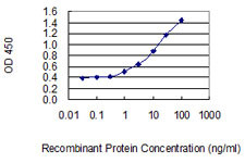 MGAT2 Antibody in ELISA (ELISA)