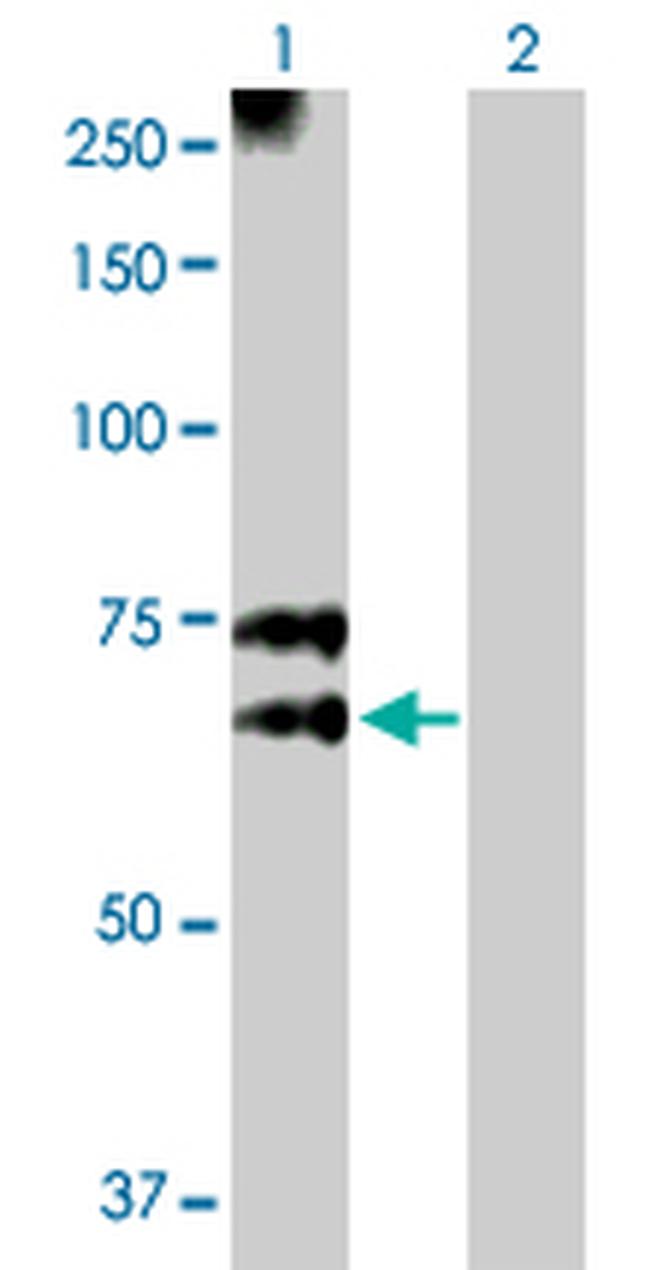 MGAT3 Antibody in Western Blot (WB)