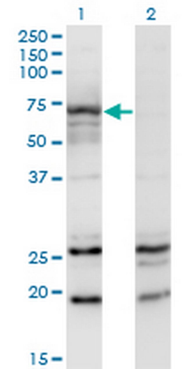 MGAT3 Antibody in Western Blot (WB)