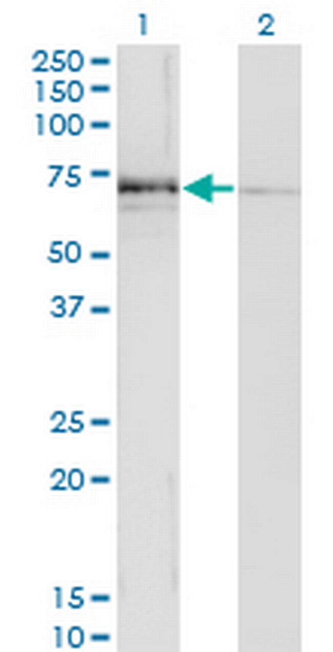 MGAT3 Antibody in Western Blot (WB)
