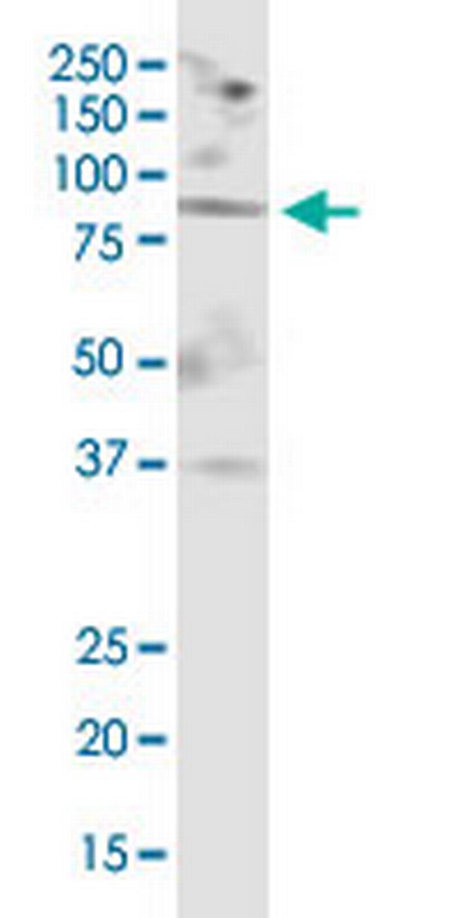 MGAT5 Antibody in Western Blot (WB)