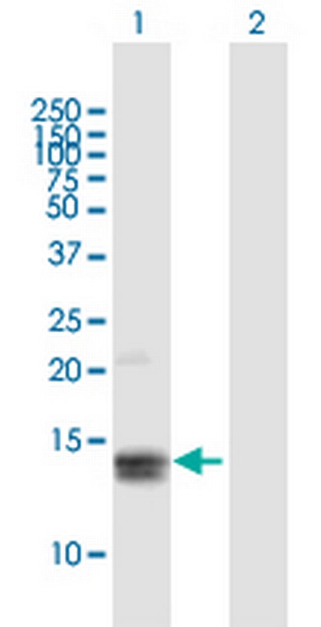 MGP Antibody in Western Blot (WB)