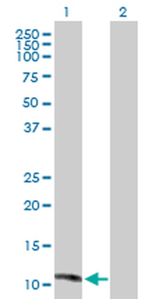 MGP Antibody in Western Blot (WB)