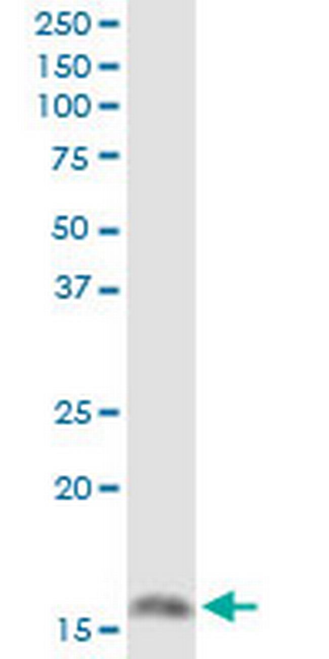 MGST1 Antibody in Western Blot (WB)