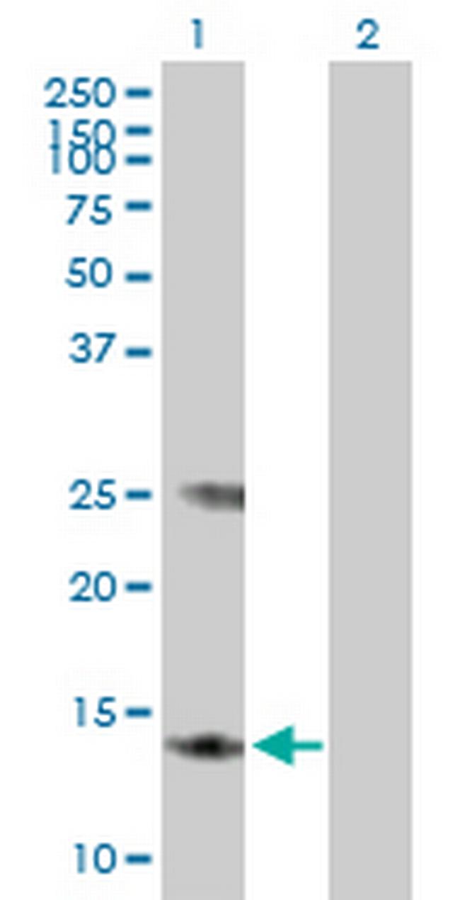 MGST3 Antibody in Western Blot (WB)