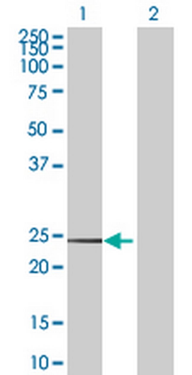 CD99 Antibody in Western Blot (WB)