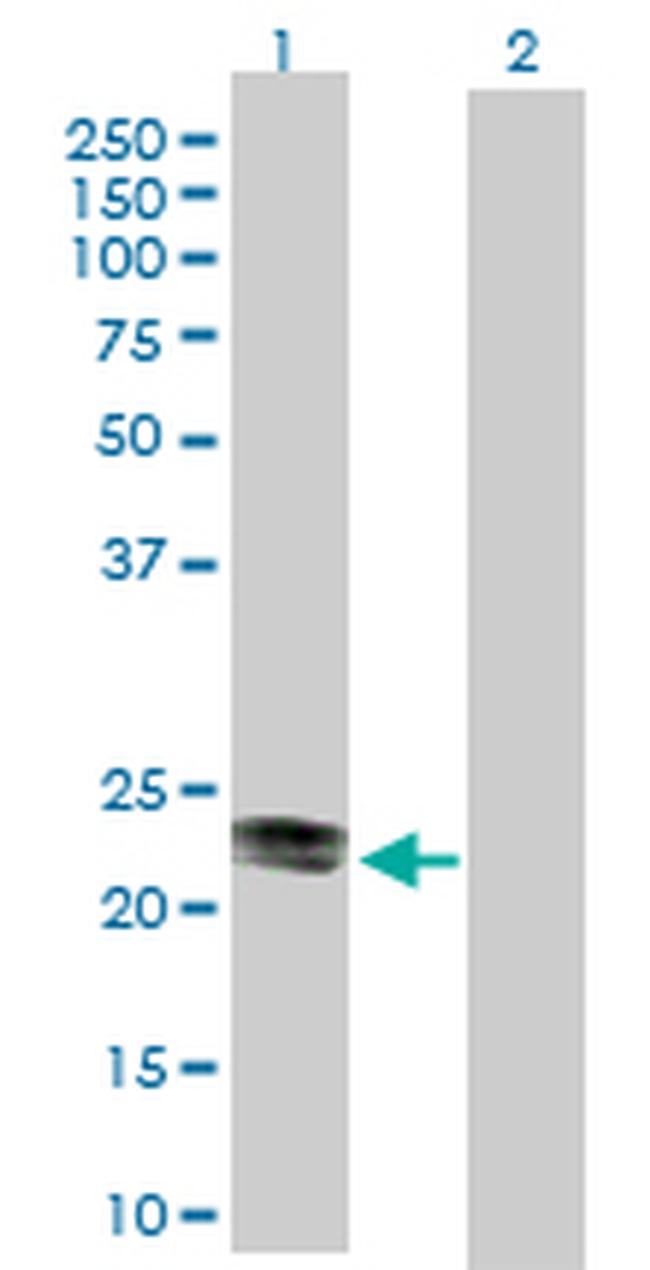 CD99 Antibody in Western Blot (WB)