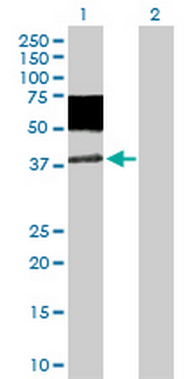 MICA Antibody in Western Blot (WB)